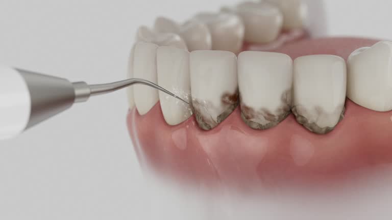 Reliable Dental contractor in New Burlington, OH by Dentist Open Now